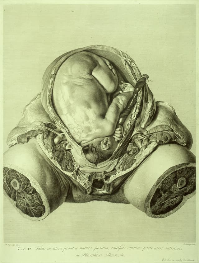 The Gravid Uterus, William Hunter, drawn by Jan van Rymsdyk