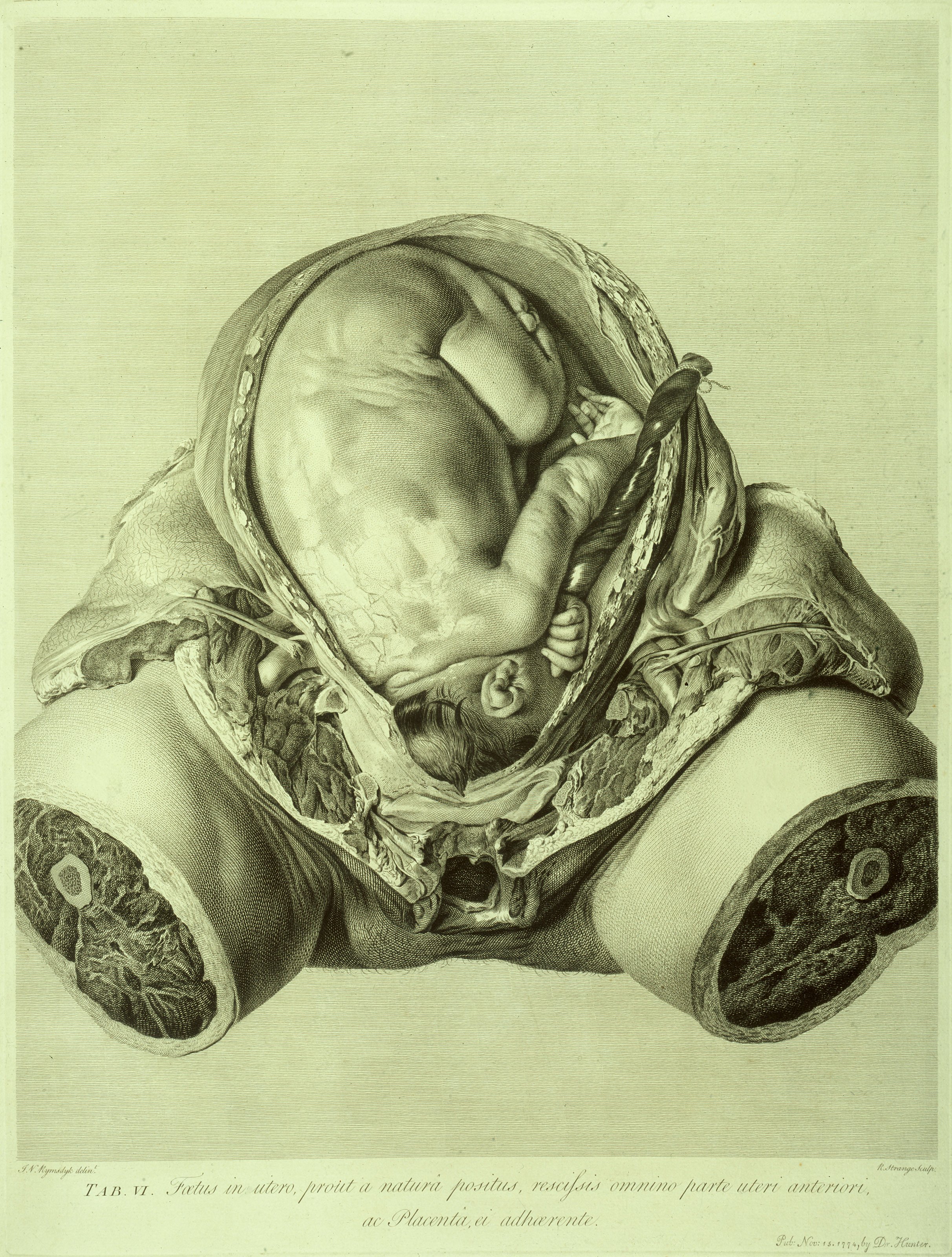 The Gravid Uterus — from The Anatomy of the Human Gravid Uterus, William Hunter, drawn by Jan van Rymsdyk, 1774
